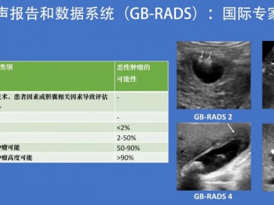 《胆囊壁增厚超声检查评估分级系统国际专家共识》解读