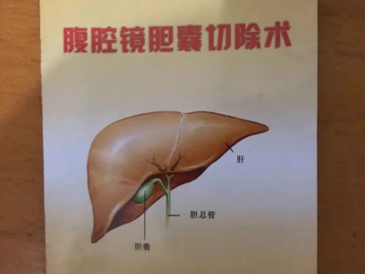 浙江大学医学院关于胆囊切除手术的宣教手册