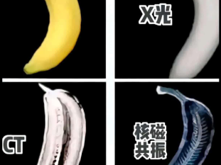 胆囊检查B超、CT、核磁各有什么优点？